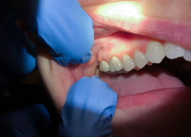 Best Pediatric Emergency Dentist in Temesl Valley, CA