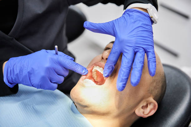 Best Emergency Dental Services for Seniors in Temesl Valley, CA